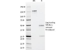 SDS-PAGE Analysis Purified EBV Mouse Monoclonal Antibody (1108-1). (EBV EA anticorps)