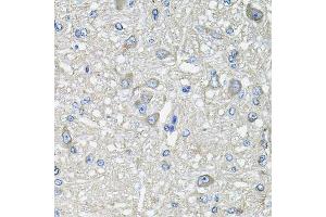 Immunohistochemistry of paraffin-embedded rat brain using GFPT1 antibody.