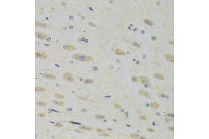 Immunohistochemistry of paraffin-embedded rat brain using RPL9 Antibody.