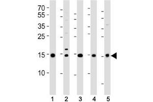 Western blot analysis of lysate from (1) 293T, (2) HeLa, (3) HL-60, (4) Jurkat cell lines and (5) rat liver tissue using SUMO2/3 antibody at 1:1000. (SUMO2/3 anticorps  (AA 49-81))