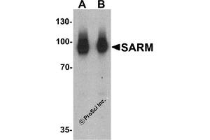 Western Blotting (WB) image for anti-Sterile alpha and TIR Motif Containing 1 (SARM1) (N-Term) antibody (ABIN1031550) (SARM1 anticorps  (N-Term))