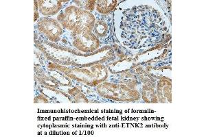 Image no. 1 for anti-Ethanolamine Kinase 2 (ETNK2) antibody (ABIN1576385) (Ethanolamine Kinase 2 anticorps)