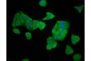 Immunofluorescence staining of HepG2 cells with ABIN7151530 at 1:166, counter-stained with DAPI. (ELMOD3 anticorps  (AA 1-102))