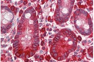 anti-Eukaryotic Translation Elongation Factor 2 (EEF2) (pThr56) antibody