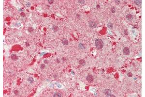 Rabbit Anti-ALDOB antibody  Formalin Fixed Paraffin Embedded Tissue: Human Liver Primary antibody Concentration: 1:100 Secondary Antibody: Donkey anti-Rabbit-Cy3 Secondary Antibody Concentration: 1:200 Magnification: 20x Exposure Time: 0.