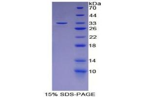 SDS-PAGE analysis of Mouse LCP2 Protein.