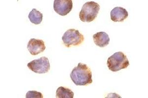 Immunocytochemistry of IRAK-4 in K562 cells with AP30442PU-N IRAK-4 antibody at 10 μg/ml.