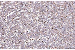 IHC analysis of DAB2 using anti-DAB2 antibody (ABIN7602613). (DAB2 anticorps  (AA 89-770))