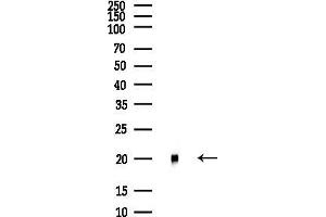 anti-Phosphatidylethanolamine Binding Protein 1 (PEBP1) (C-Term) antibody