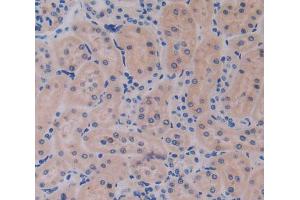 IHC-P analysis of kidney tissue, with DAB staining. (IL17RE anticorps  (AA 457-626))