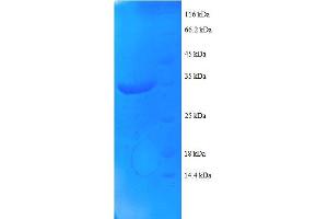 NADH Dehydrogenase (Ubiquinone) 1 alpha Subcomplex, 1, 7.