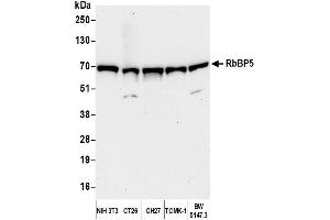 Western Blotting (WB) image for anti-Retinoblastoma Binding Protein 5 (RBBP5) (C-Term) antibody (ABIN7449051)