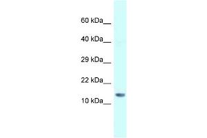 WB Suggested Anti-Gm14277 Antibody   Titration: 1. (Gm14277 anticorps  (N-Term))