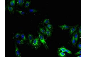Immunofluorescent analysis of Hela cells using ABIN7149255 at dilution of 1:100 and Alexa Fluor 488-congugated AffiniPure Goat Anti-Rabbit IgG(H+L) (CYP2U1 anticorps  (AA 363-496))