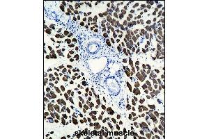 ACTA1 Antibody (ABIN1536597 and ABIN2843809) immunohistochemistry analysis in formalin fixed and paraffin embedded human skeletal muscle followed by peroxidase conjμgation of the secondary antibody and DAB staining. (Actin anticorps)