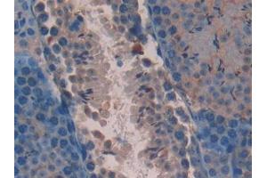DAB staining on IHC-P; Samples: Mouse Testis Tissue (AATK anticorps  (AA 137-386))