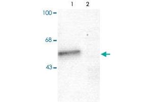 Western blot of mouse forebrain lysates from Wild Type (Control, lane 1) and Gabra1 knockout (Gabra1-K/O, lane 2) animals showing specific immunolabeling of the ~51 alpha1-subunit of the Gabra1. (GABRA1 anticorps  (N-Term))