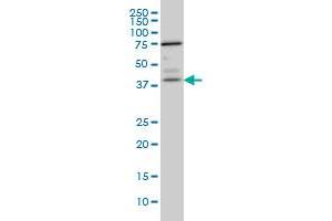 Western Blotting (WB) image for anti-Paraneoplastic Antigen MA1 (PNMA1) (AA 62-161) antibody (ABIN598600) (PNMA1 anticorps  (AA 62-161))