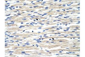 CBX6 antibody was used for immunohistochemistry at a concentration of 4-8 ug/ml to stain Skeletal muscle cells (arrows) in Human Muscle. (CBX6 anticorps  (N-Term))