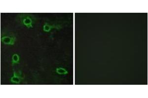 Immunofluorescence analysis of COS7 cells, using ADORA2A Antibody. (Adenosine A2a Receptor anticorps  (AA 120-169))