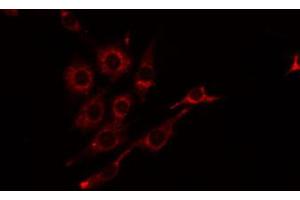 ABIN6274815 staining Hela by IF/ICC.
