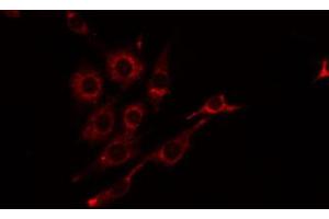 ABIN6274815 staining Hela by IF/ICC. (BST1 anticorps  (Internal Region))