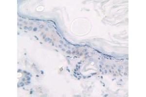 IHC-P analysis of Kidney tissue, with DAB staining. (KRT14 anticorps  (AA 122-429))