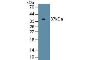 Detection of Recombinant EXOSC2, Human using Polyclonal Antibody to Exosome Component 2 (EXOSC2) (EXOSC2 anticorps  (AA 1-293))