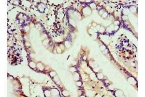 Immunohistochemistry of paraffin-embedded human small intestine tissue using ABIN7150217 at dilution of 1:100