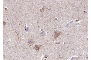 ABIN6267418 at 1/100 staining human brain tissue sections by IHC-P. (GABA-RB (pSer434) anticorps)
