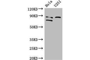 Western Blot Positive WB detected in: Hela whole cell lysate, U251 whole cell lysate All lanes: FCHO2 antibody at 3 μg/mL Secondary Goat polyclonal to rabbit IgG at 1/50000 dilution Predicted band size: 89, 44, 86 kDa Observed band size: 89, 86 kDa (FCHO2 anticorps  (AA 100-203))