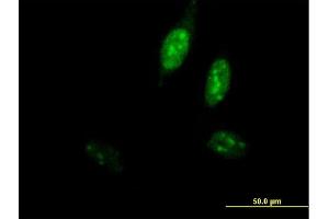Immunofluorescence of purified MaxPab antibody to POLE3 on HeLa cell.
