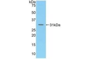 Detection of Recombinant MAdCAM1, Mouse using Polyclonal Antibody to Mucosal Addressin Cell Adhesion Molecule 1 (MAdCAM1) (MADCAM1 anticorps  (AA 29-297))
