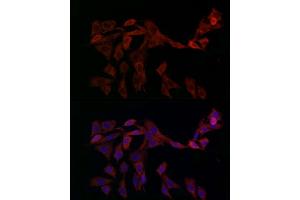 Immunofluorescence analysis of PC-12 cells using OP antibody (ABIN6129426, ABIN6145031, ABIN6145032 and ABIN6225150) at dilution of 1:100 (40x lens). (OPA1 anticorps  (AA 661-960))