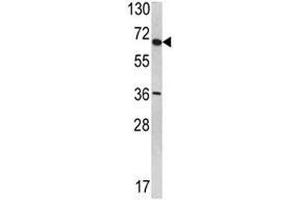 Western blot analysis of SYVN1 antibody in T47D lysate