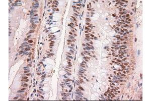 Image no. 1 for anti-Myc Proto-Oncogene protein (MYC) antibody (ABIN1497012) (c-MYC anticorps)