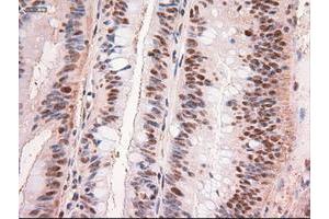 Image no. 1 for anti-Myc Proto-Oncogene protein (MYC) antibody (ABIN1497012)