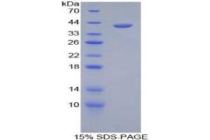 SDS-PAGE analysis of Human Hemojuvelin Protein. (HFE2 Protéine)
