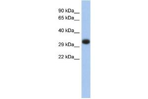 WB Suggested Anti-HLA-DPA1 Antibody Titration:  0. (HLA-DPA1 anticorps  (Middle Region))
