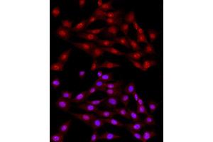 Immunofluorescence analysis of NIH/3T3 cells using DNA Ligase III/LIG3 Rabbit pAb (ABIN6130288, ABIN6143207, ABIN6143208 and ABIN6217532) at dilution of 1:50 (40x lens).