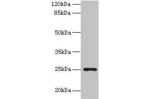 Western blot All lanes: FGFBP2 antibody at 2 μg/mL + Human serum Secondary Goat polyclonal to rabbit IgG at 1/10000 dilution Predicted band size: 25 kDa Observed band size: 25 kDa (FGFBP2 anticorps  (AA 20-223))