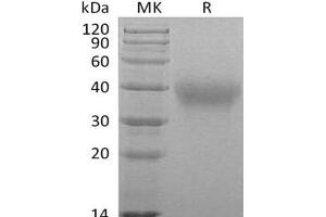 Hepatitis A Virus Cellular Receptor 2 (TIM 3) protein (His tag)