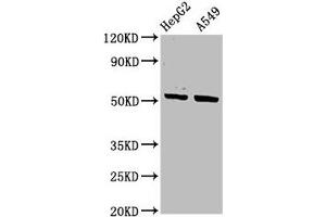 Western Blot Positive WB detected in: HepG2 whole cell lysate, A549 whole cell lysate All lanes: KRT16 antibody at 3.