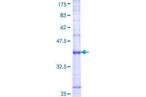 Image no. 1 for Dual Specificity Phosphatase 8 (DUSP8) (AA 2-109) protein (GST tag) (ABIN1352144)