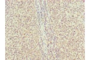 Immunohistochemistry of paraffin-embedded human tonsil tissue using ABIN7151143 at dilution of 1:100 (RNF13 anticorps  (AA 204-381))