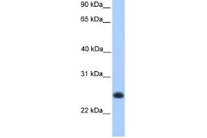 WB Suggested Anti-C12orf68 Antibody Titration: 0. (C12ORF68 anticorps  (Middle Region))