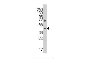 Western blot analysis of anti-LEFTB Pab in HL60 cell line lysates (35ug/lane).