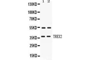 Western blot analysis of TREX2 expression in HELA whole cell lysates ( Lane 1) and MCF-7 whole cell lysates ( Lane 2). (TREX2 anticorps  (AA 69-279))