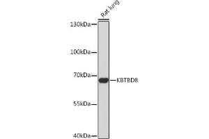 Western blot analysis of extracts of Rat lung, using KBTBD8 Rabbit pAb (ABIN7268076) at 1:1000 dilution. (KBTBD8 anticorps)