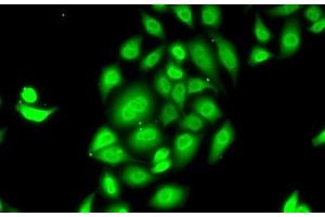 Immunofluorescence analysis of MCF7 cells using SPDEF Polyclonal Antibody (SPDEF/PSE anticorps)